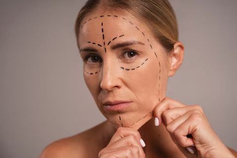 Wrinkle Treatment Complete Guide to Skin Care Approaches and Aging Support